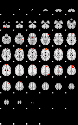 Patients 29201 85