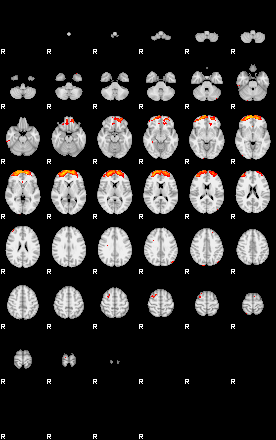 Patients 29185 90