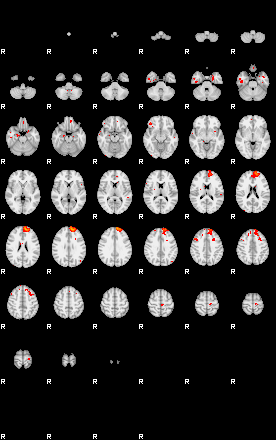 Patients 29208 130