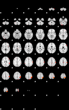 Patients 29111 97