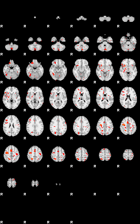 Patients 30001 76