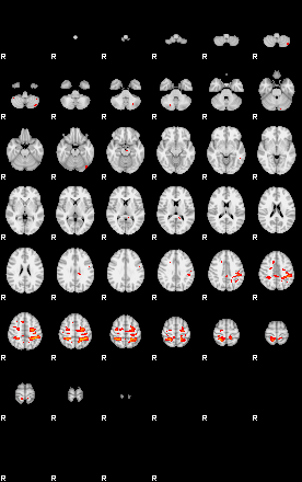 Patients 29100 121