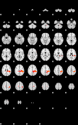 Patients 28818 93