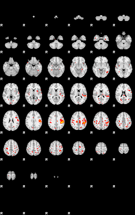 Patients 29012 162