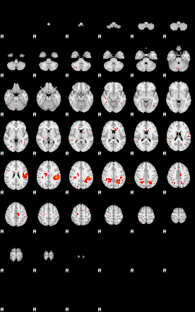 Patients 29015 69