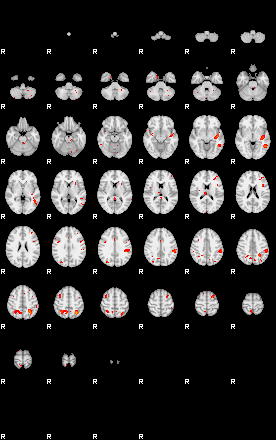 Patients 29030 156