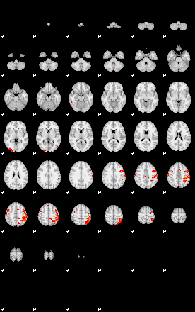 Patients 29110 190