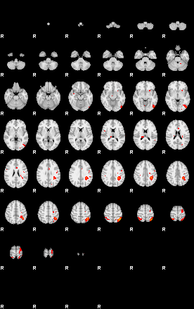 Patients 29154 102