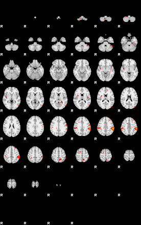 Patients 29211 22