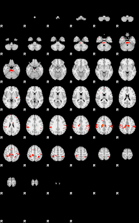 Patients 29401 56