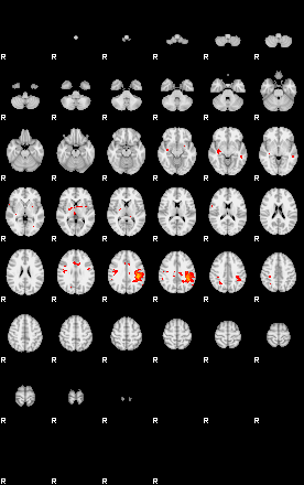 Patients 29481 70