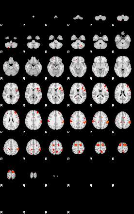 Patients 29670 33