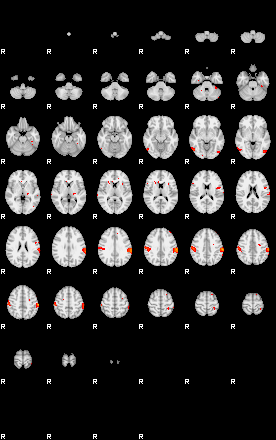 Patients 29170 132