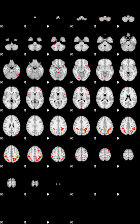 Patients 30175 40