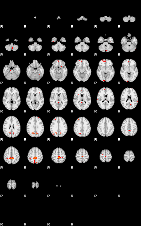 Patients 29017 59