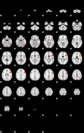 Patients 28899 195