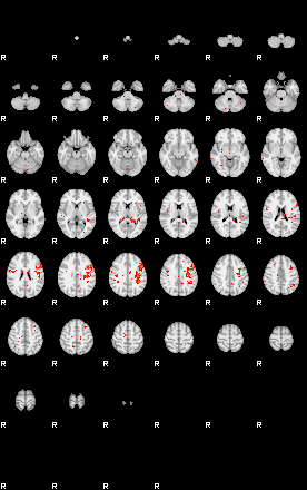 Patients 28949 94