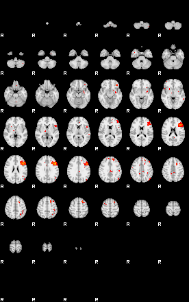 Patients 29009 46