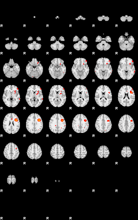 Patients 29060 181