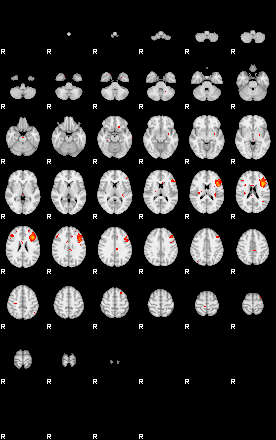 Patients 29109 187