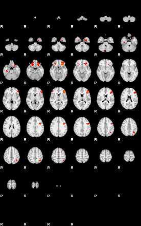 Patients 29112 29