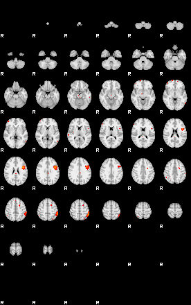 Patients 29151 4