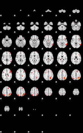 Patients 29151 60