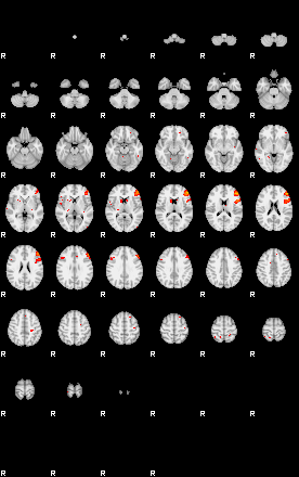 Patients 29153 30