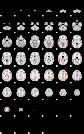 Patients 29157 200