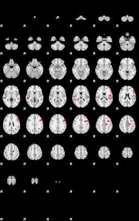 Patients 29160 170