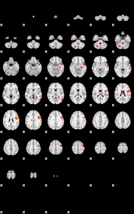 Patients 29160 70