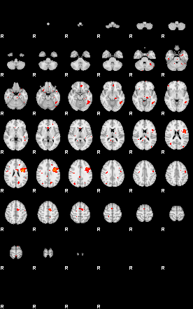 Patients 29163 58