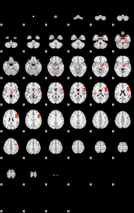 Patients 29170 180