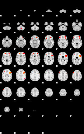 Patients 29171 43