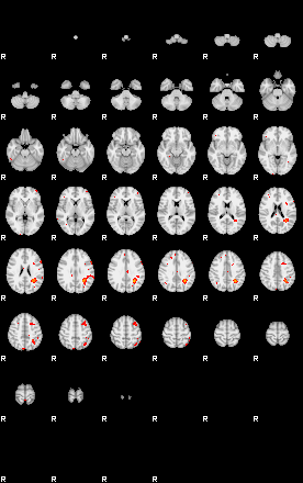 Patients 29175 37