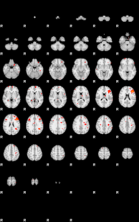 Patients 29176 44