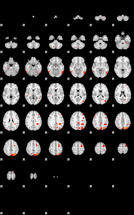 Patients 29183 74