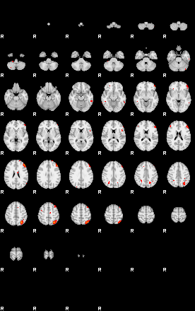 Patients 29184 33