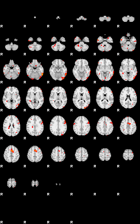 Patients 29186 152