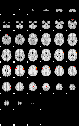 Patients 29200 107