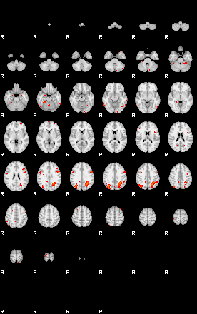 Patients 29202 2