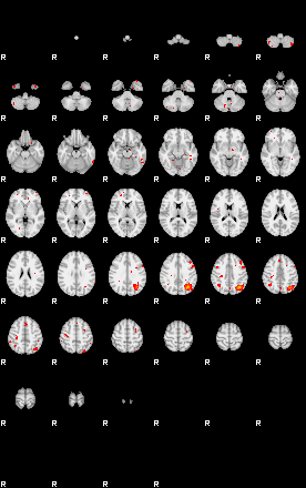 Patients 29203 70