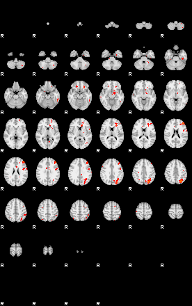 Patients 29206 69