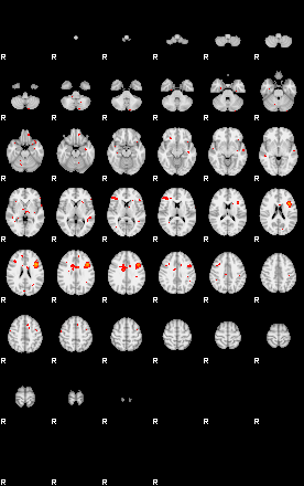 Patients 29224 192