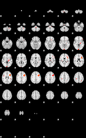 Patients 29275 195