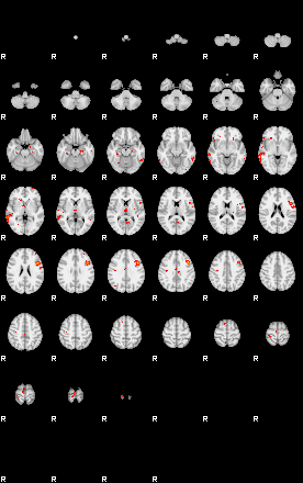 Patients 29279 190