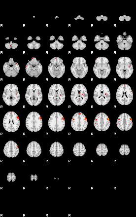 Patients 29416 137