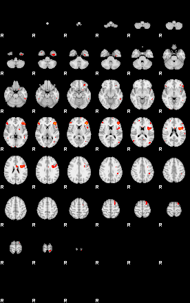 Patients 29435 30