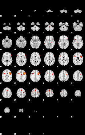 Patients 29458 194