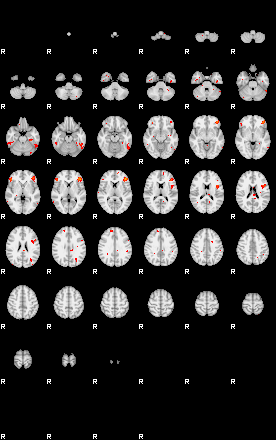 Patients 29541 31